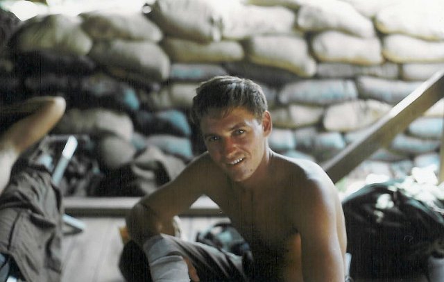 x John Wendelin w-Broken arm